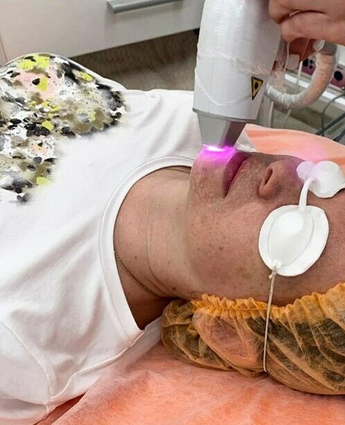 Лазерные процедуры